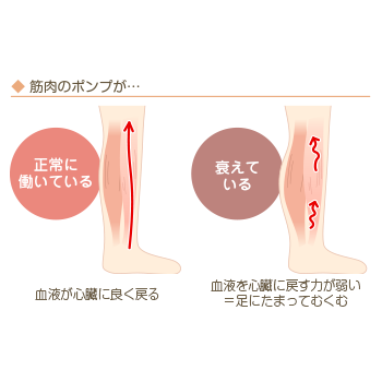 足の「冷え」と「むくみ」はどう関係しているのですか？