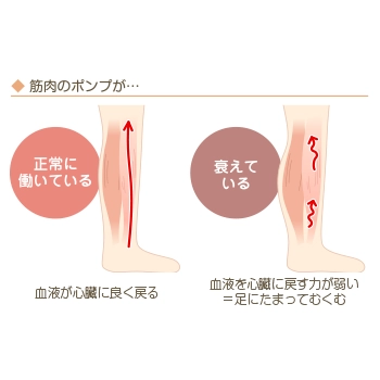 足のむくみと冷えの関係とは？原因と効果的な対策を紹介